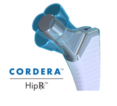 Cordera HipRx Hip Replacement