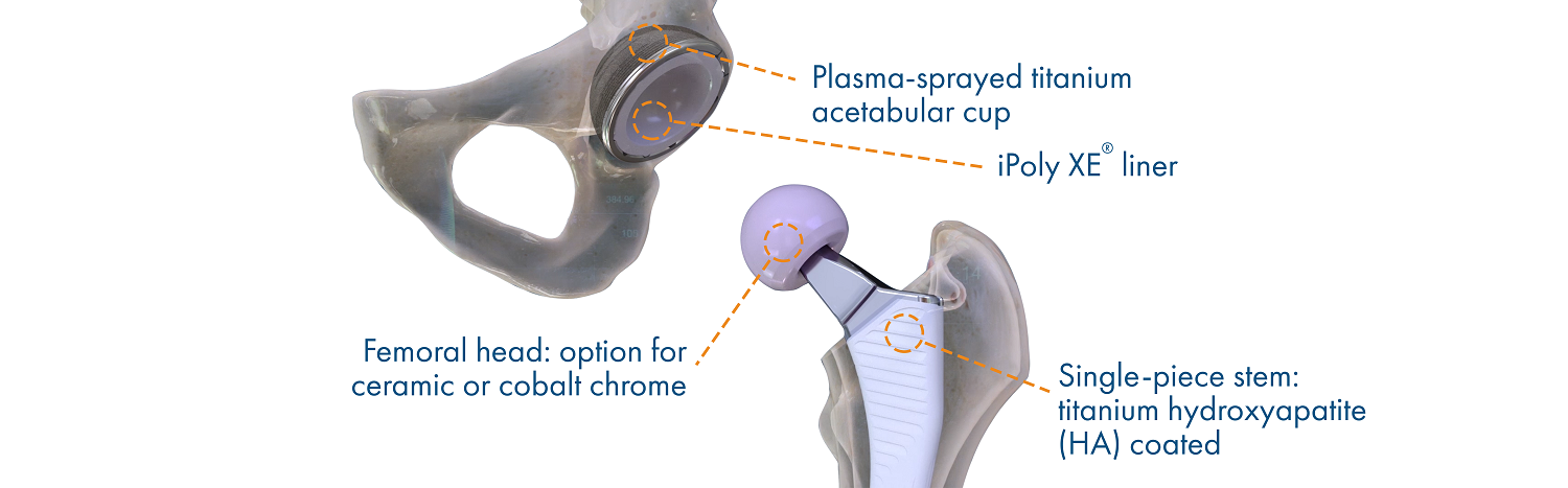 hip implant materials