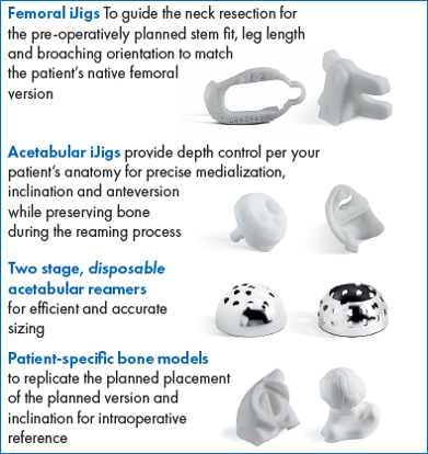 Conformis iJig details